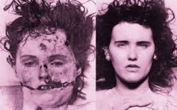 POLLOCK TWINS (The Mystery)